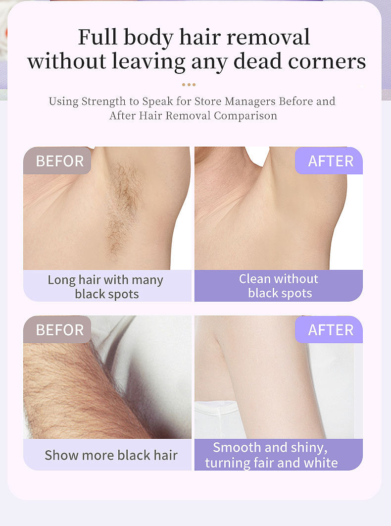 5-in-1 Electric Lady Shaver & Grooming Kit - LCD Display, USB-C Rechargeable, Full Body Hair Removal(White)